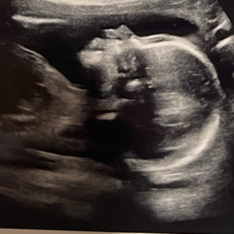 Babylist Registry Photo.