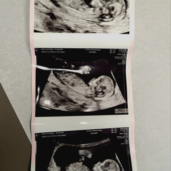 Babylist Registry Photo.
