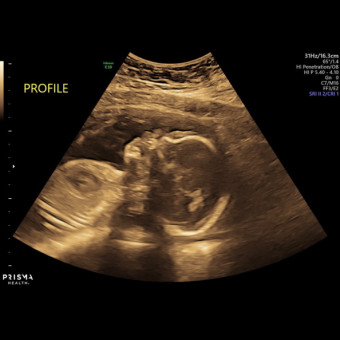 Babylist Registry Photo.