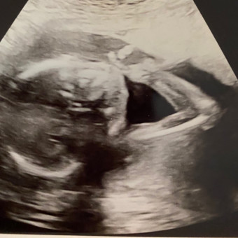 Alexandra's Baby Registry Photo.