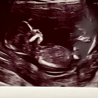 Babylist Registry Photo.