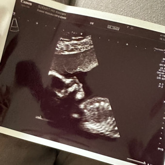 Baby Kenolio Photo.