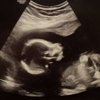 Babylist Registry Photo.