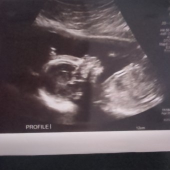 Caitlin's Baby Registry Photo.