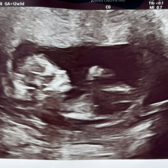 Rebecca's Baby Registry Photo.
