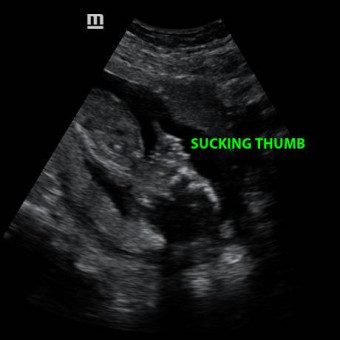 Babylist Registry Photo.