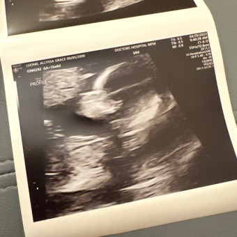 Ally's Baby Registry Photo.