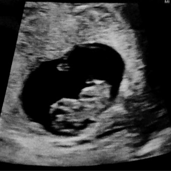 Lauren's Baby Registry Photo.