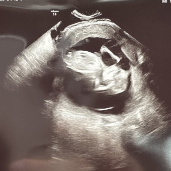 Baby Girl Longley Photo.