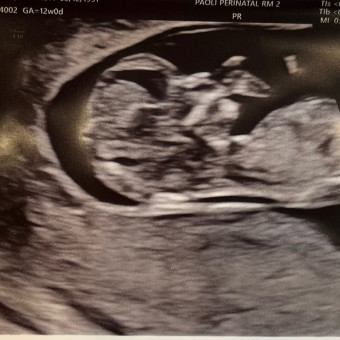Babylist Registry Photo.