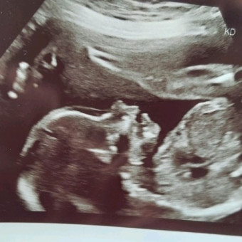 BRANDY's Baby Registry Photo.