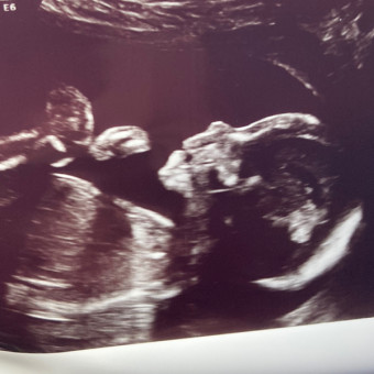 Babylist Registry Photo.