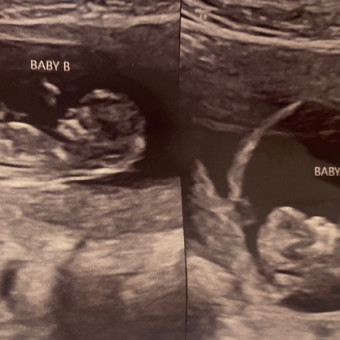 Ally's Baby Registry Photo.