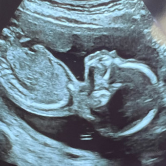 Abby's Baby Registry Photo.