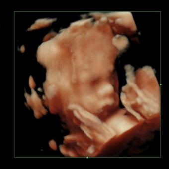 Babylist Registry Photo.