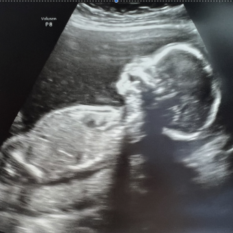 Babylist Registry Photo.
