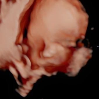 Brittany's Baby Registry Photo.