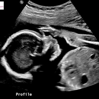 Babylist Registry Photo.