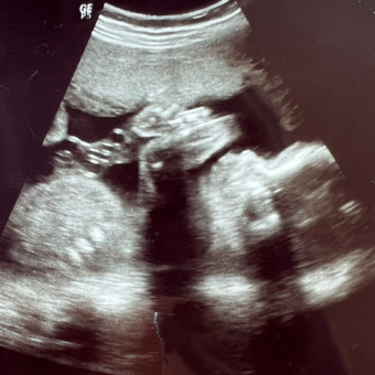 Baby Boy Pedersen’s Registry Photo.