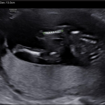 Babylist Registry Photo.