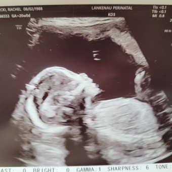 Rachel and Andrew's Baby Registry Photo.