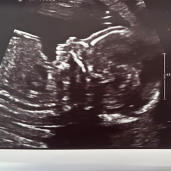Pao's Baby Registry Photo.