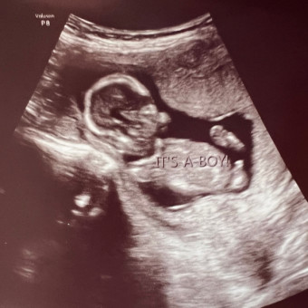 Peyton's Baby Registry Photo.