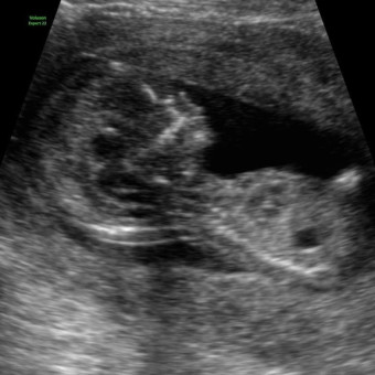 Babylist Registry Photo.