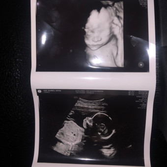 Malikai Anthony Photo.