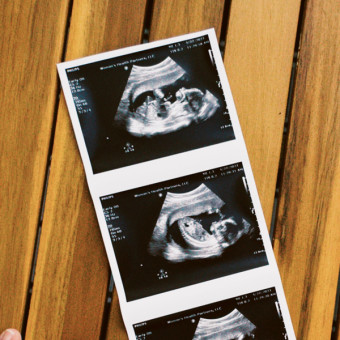 Samantha's Baby Registry Photo.