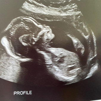Mandy's Baby Registry Photo.