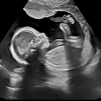 Baby Wehrman #2 Photo.