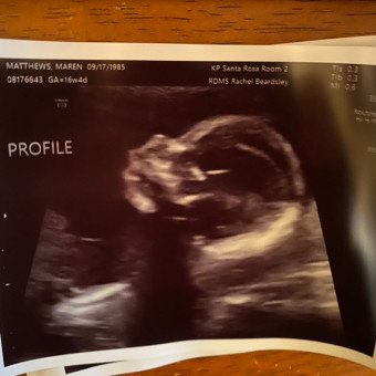 Baby MaryEllen Registry Photo.