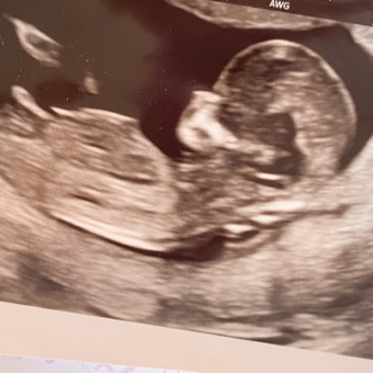 Baby Wessell Photo.