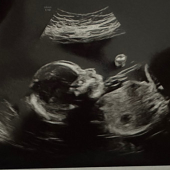 Yesenia & Jessy Baby Registry Photo.