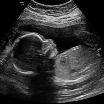 Baby boy coming soon :) Photo.