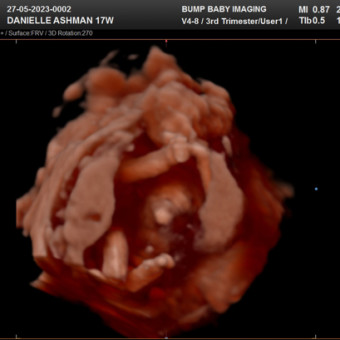 Danielle's Baby Registry Photo.