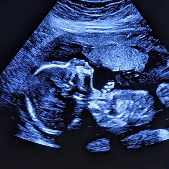Angel's & Karina's Baby Registry Photo.