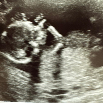 Baby Provancal Registry Photo.
