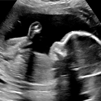 Reyes Baby Registry Photo.