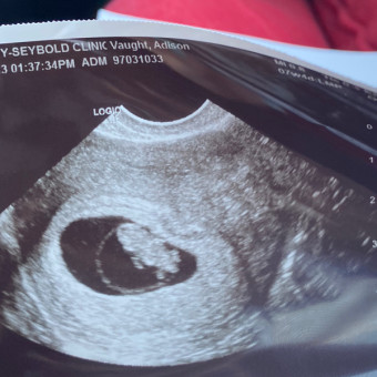 Adison's Baby Registry Photo.