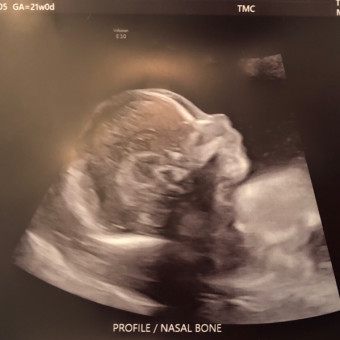 Tyler and Amber's Baby Registry Photo.