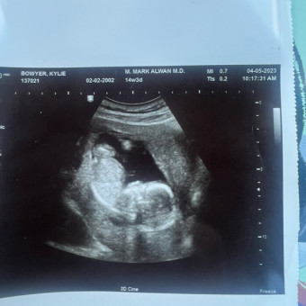 Kylie's Baby Registry Photo.