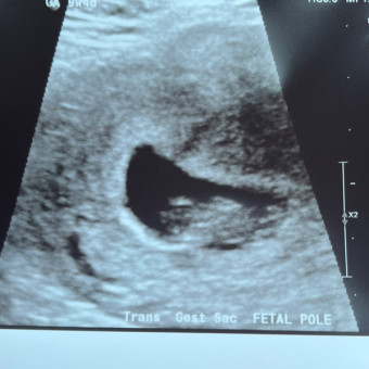 Aeriana's Baby Registry Photo.