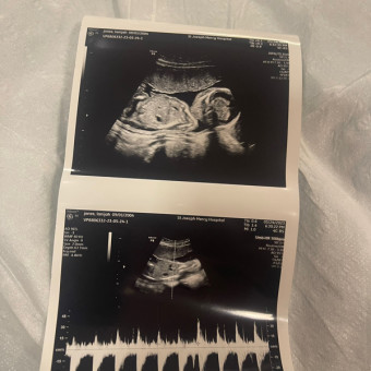 Lanijah's Baby Registry Photo.