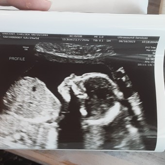 Chelsea's Baby Registry Photo.