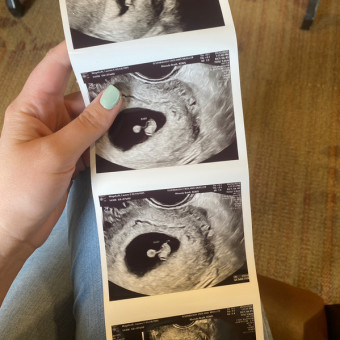 Baby #3 Photo.