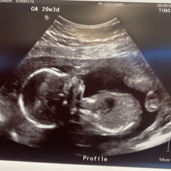 Cass's Baby Registry Photo.