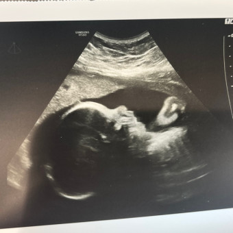 Baylee and Preston Roberts’ Baby Registry Photo.