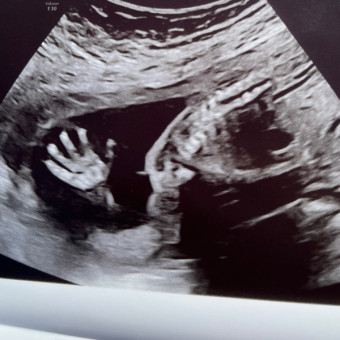Paige's Baby Registry Photo.